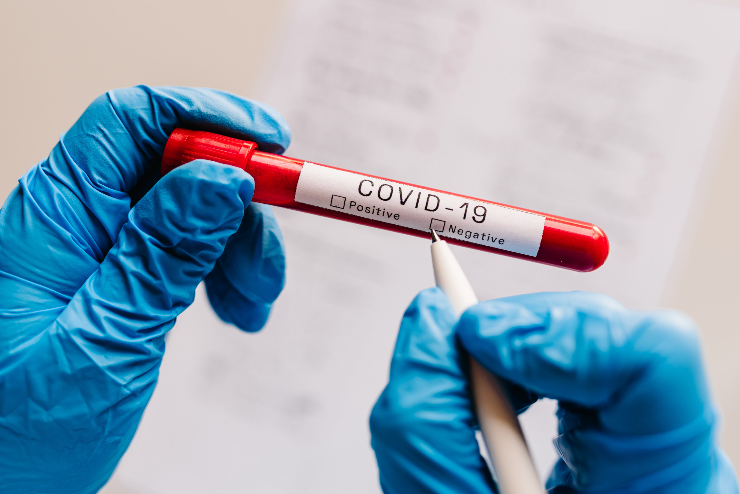 CEO Charged With Fraud in 15-Second COVID Test Scheme