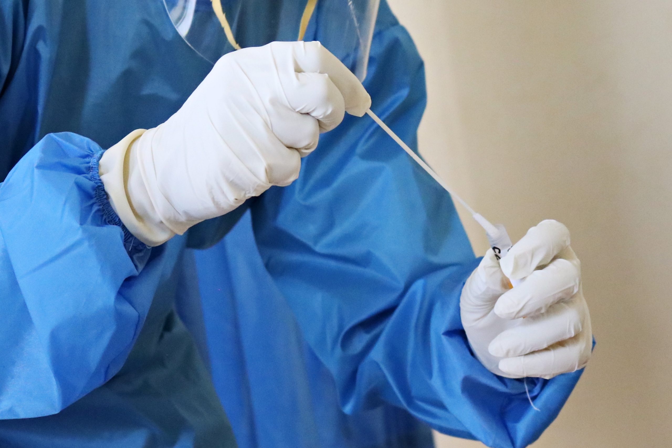DOH, RITM issue warning against COVID-19 testing fraud