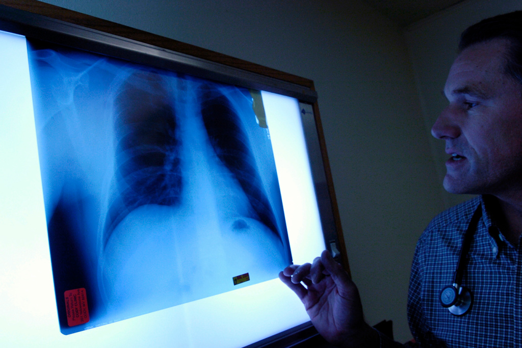 In Poisoned Montana Town, Warren Buffett-Owned Railroad Accuses Clinic of Medicare Fraud