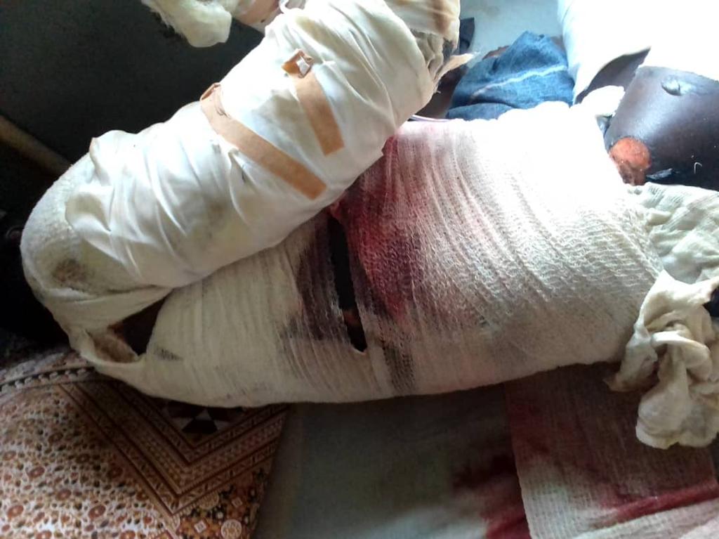 Security guards allegedly burn ‘galamseyer’ alive on Adamus concession 
