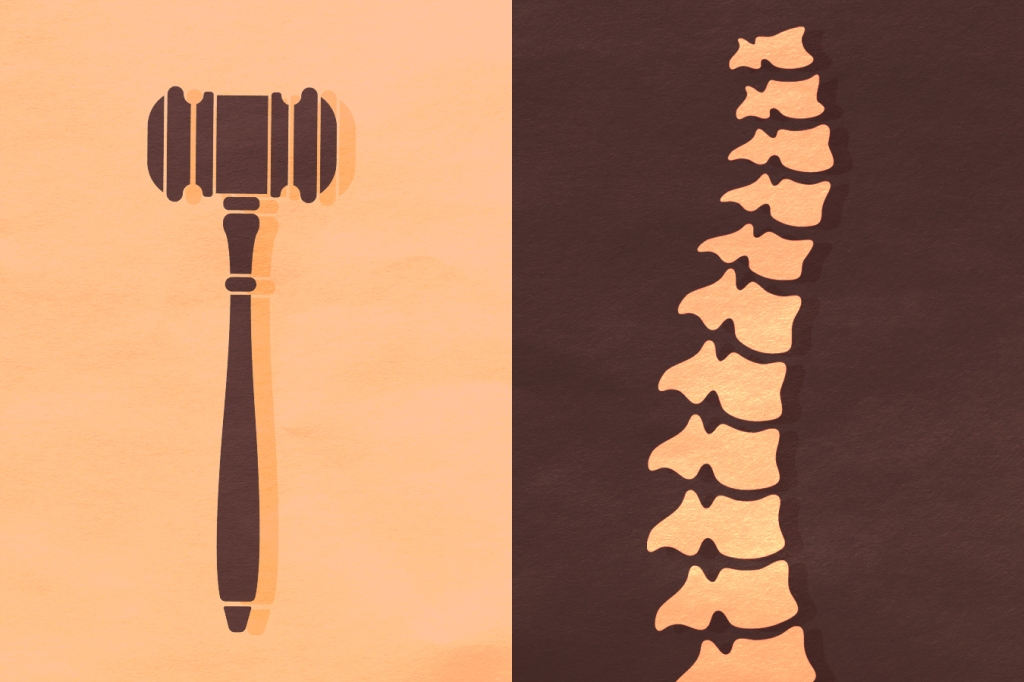Federal Investigation Into Spine Surgeries Uses Mob Laws to Target Health Care Fraud