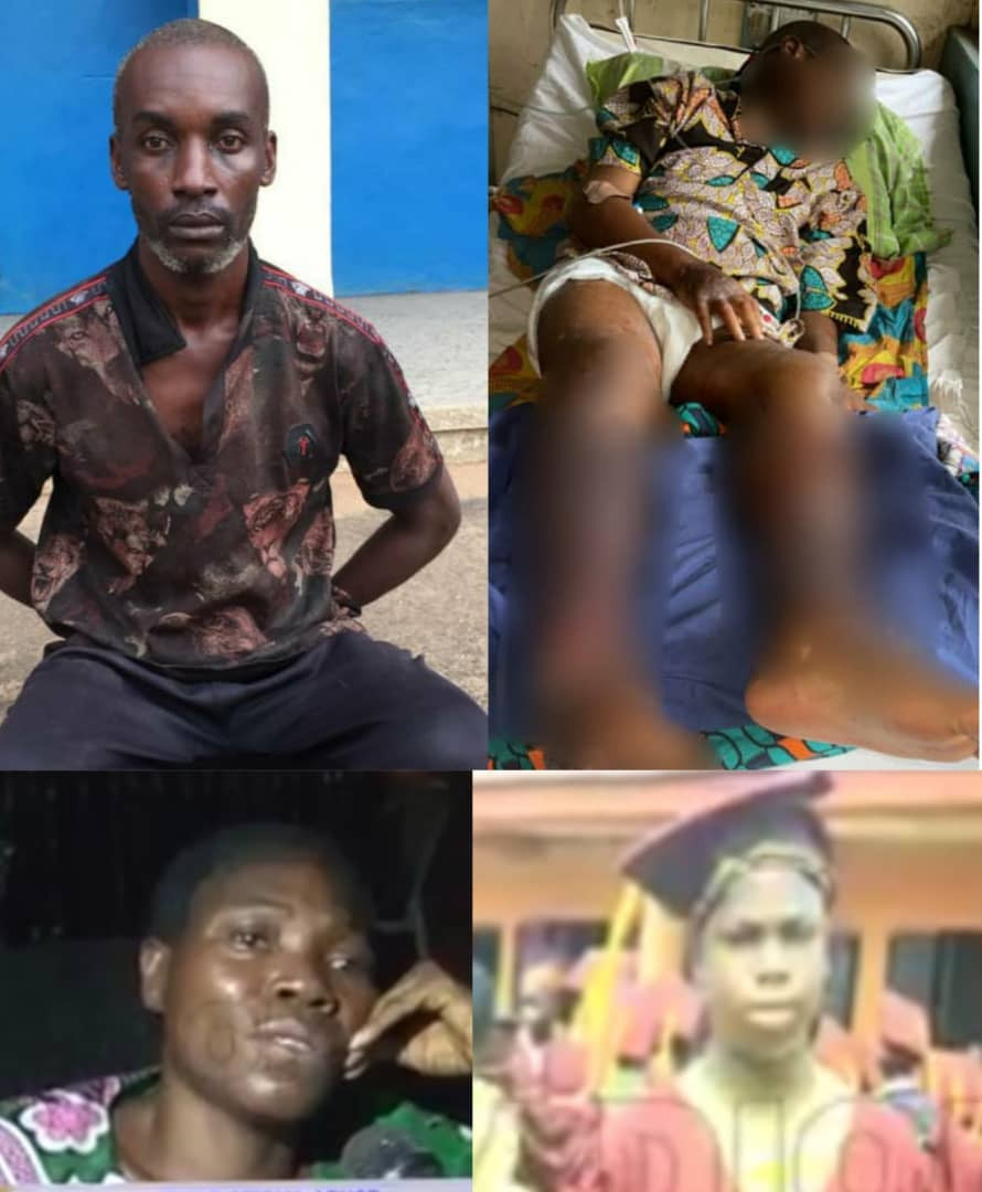 13-Year-Old Boy Dies After Rape By Security Guard In Edo